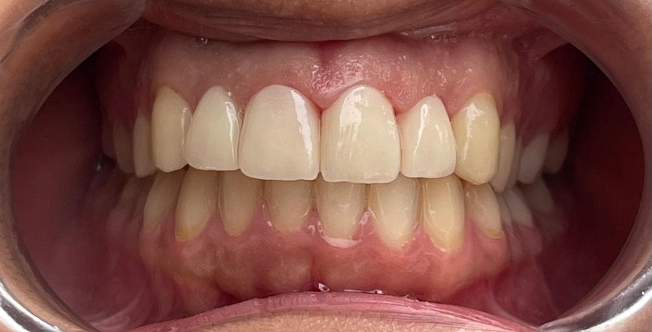 Esthetic and Cosmetic Treatment, after photo