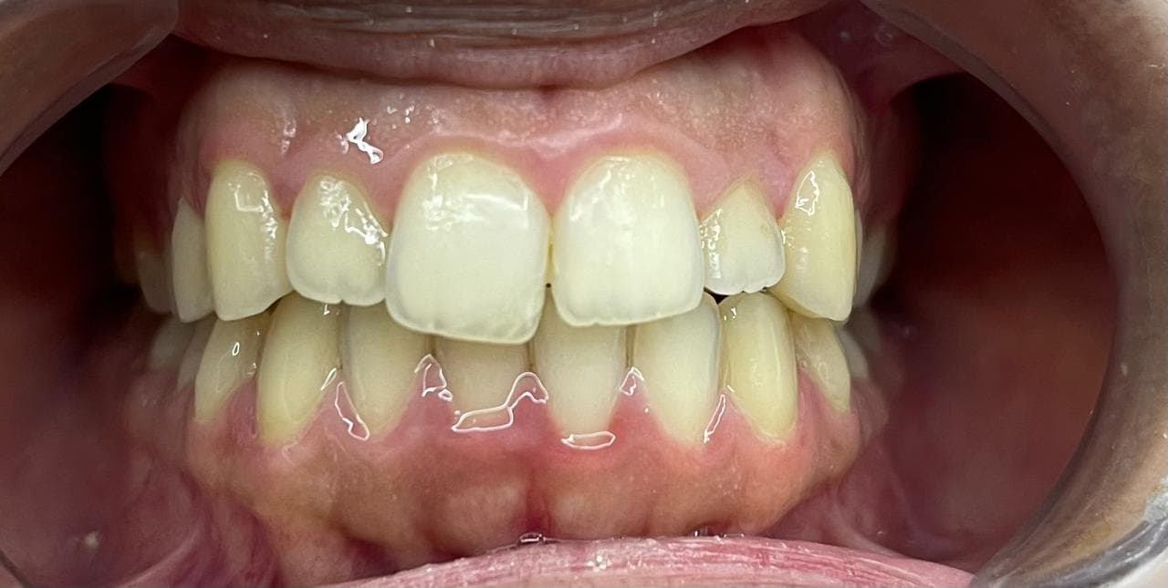 Esthetic and Cosmetic Treatment, before photo
