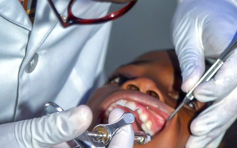 How to Prevent Cavities in Children, A Chennai Pediatric Dental Guide