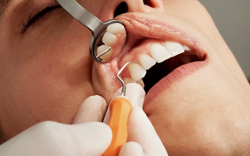 7 Signs You Need to See an Oral Surgeon (Not Just a Dentist)