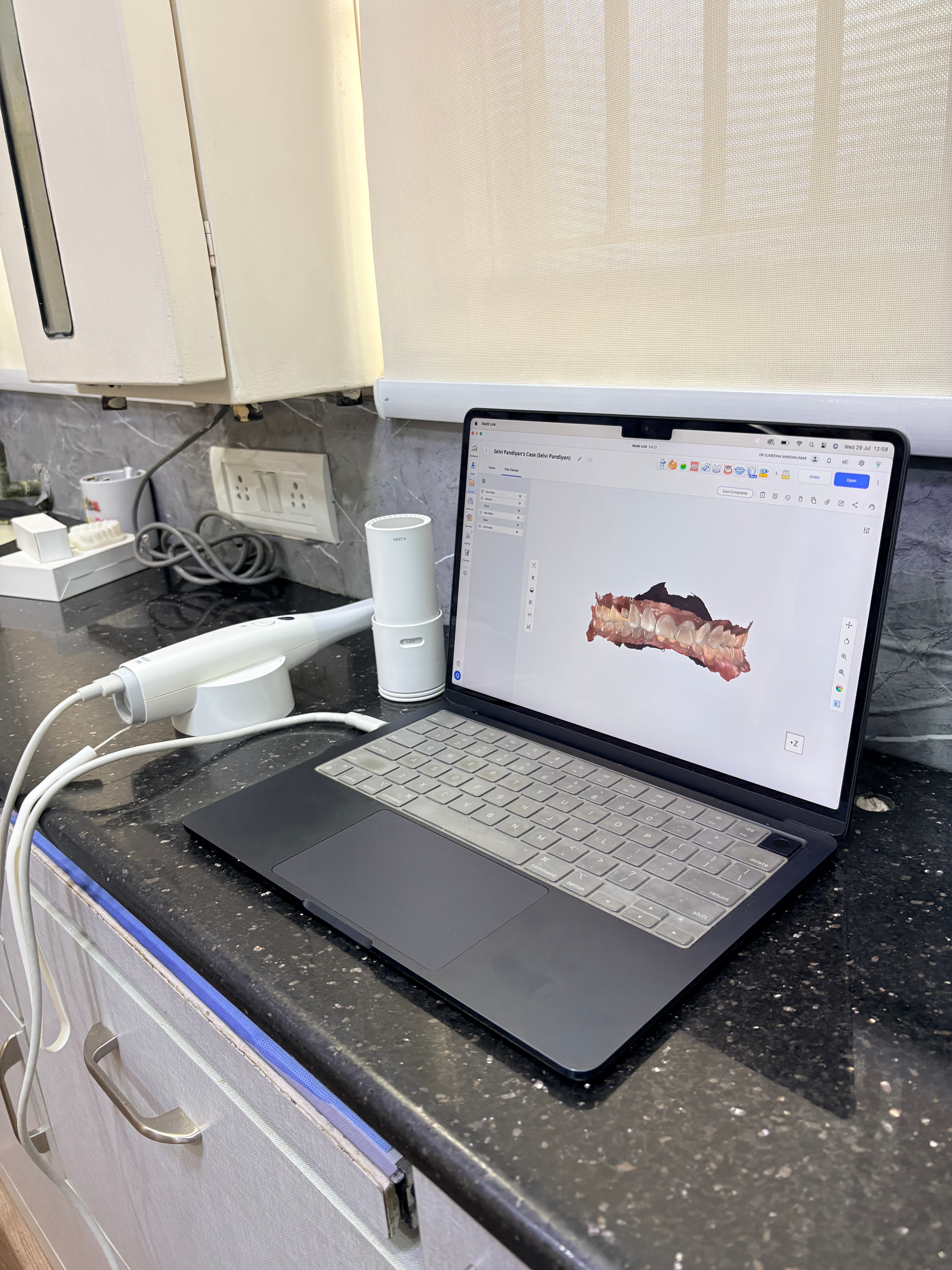 Digital Scanning