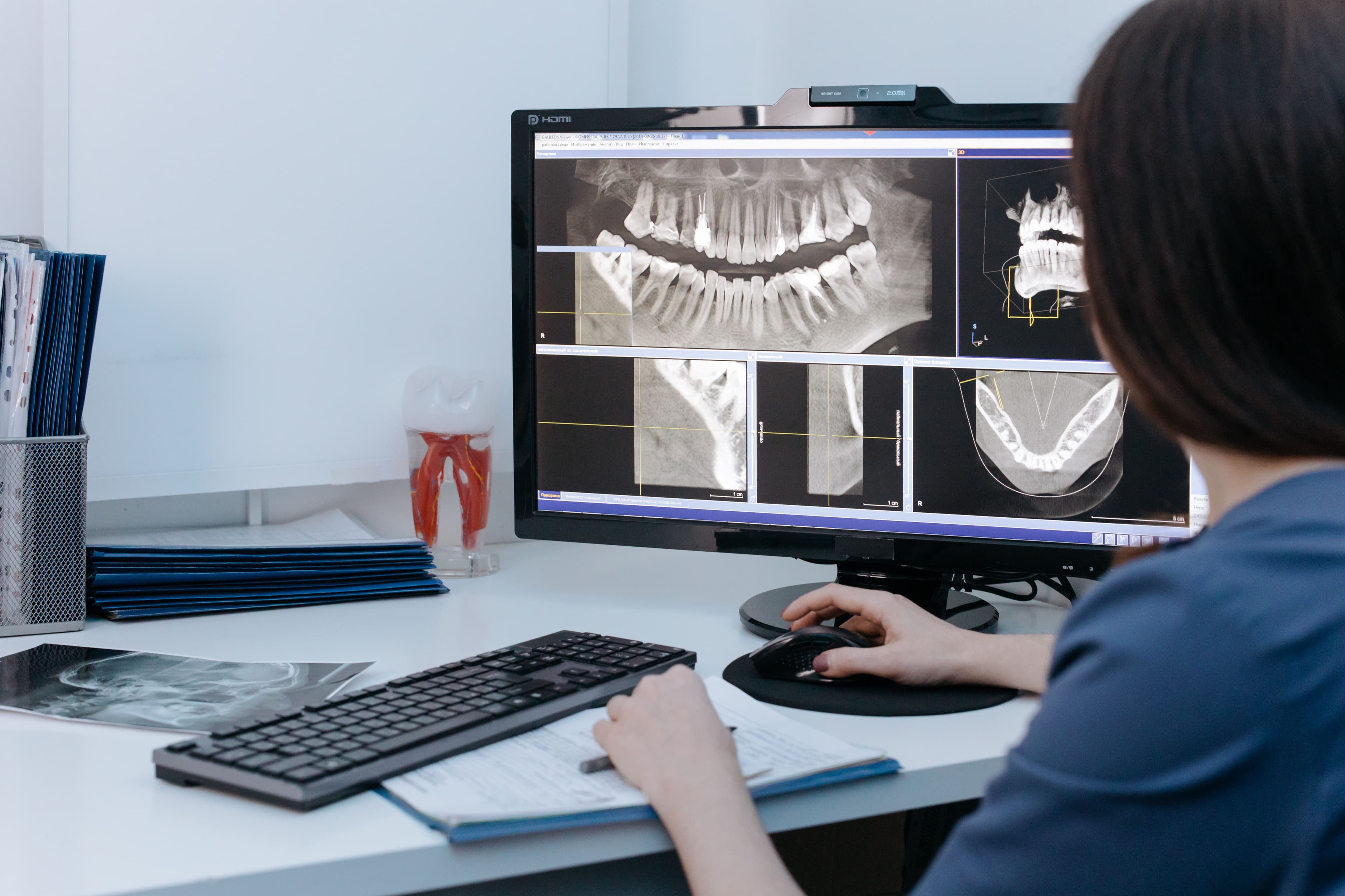 CBCT Scan