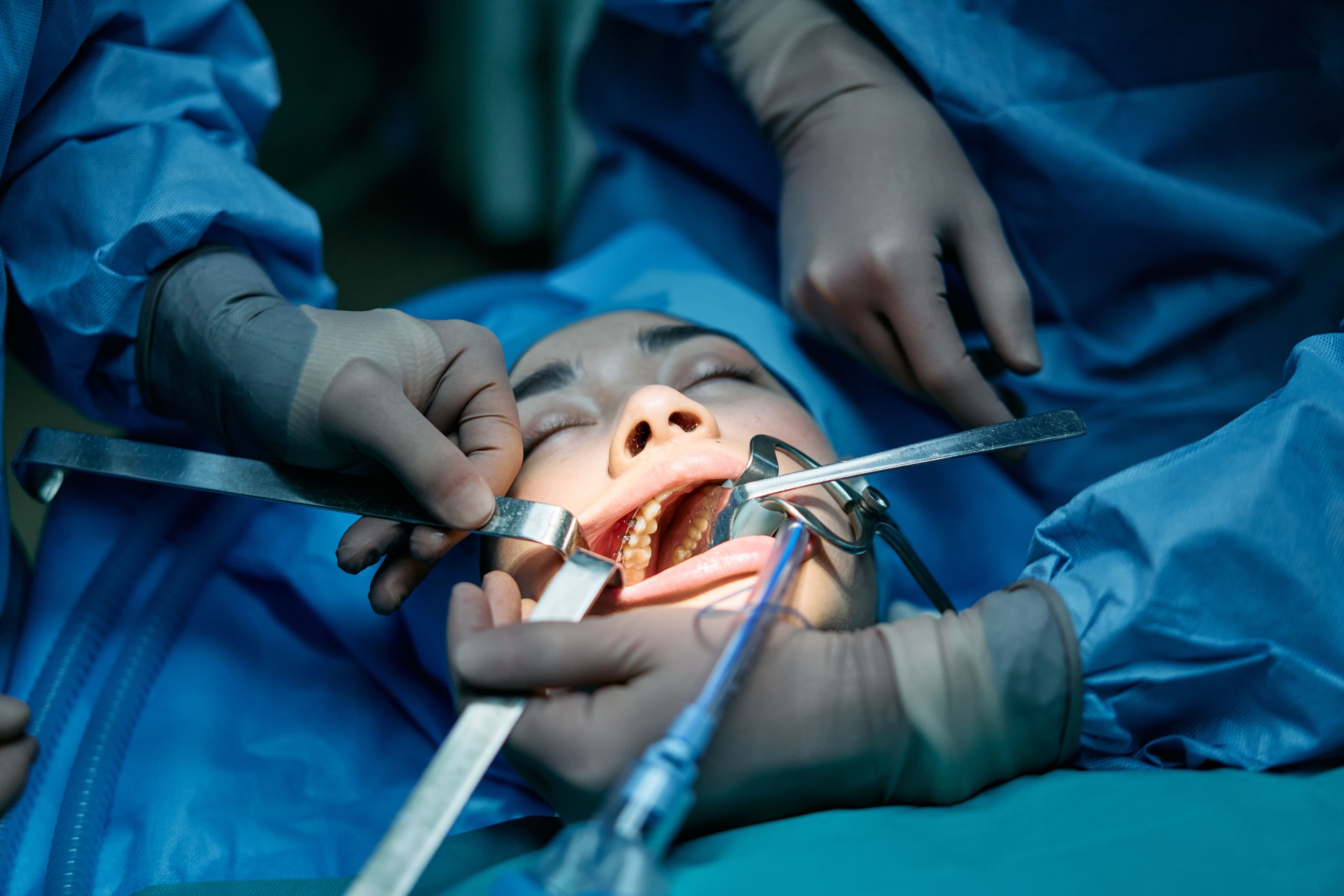 Jaw Surgery