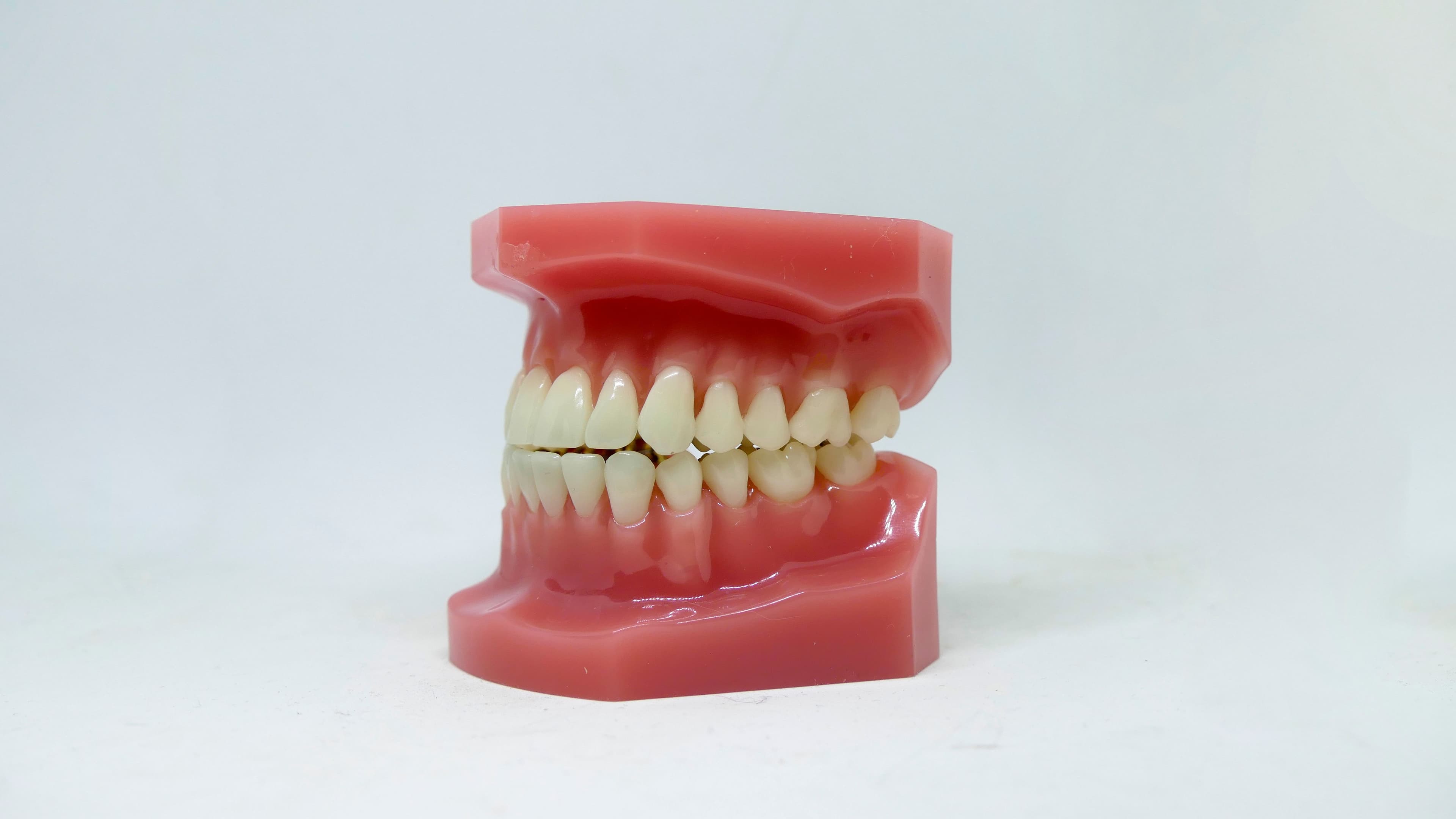 Full Mouth Rehabilitation